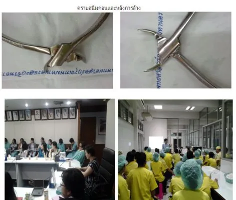 สาธิตการล้างคราบขจัดยากบนอุปกรณ์เครื่องมือทางทันตกรรม และทางการแพทย์ แสดงผลการล้างก่อนและหลัง